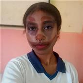 Be